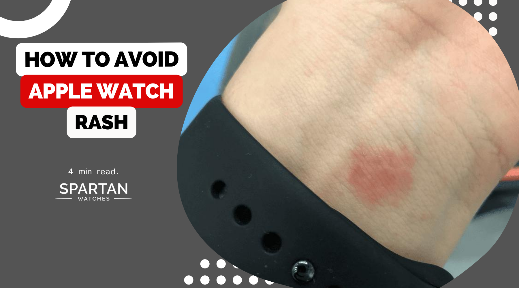 How To Avoid Apple Watch Rash – Spartan Watches